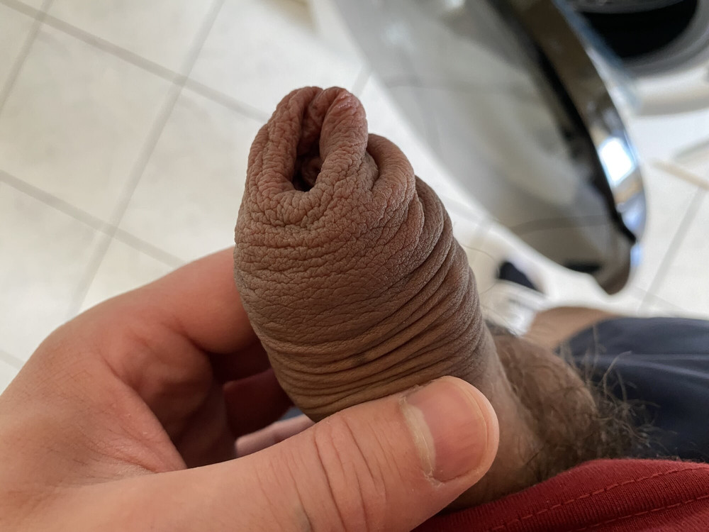 Foreskin donut ring stretching #5