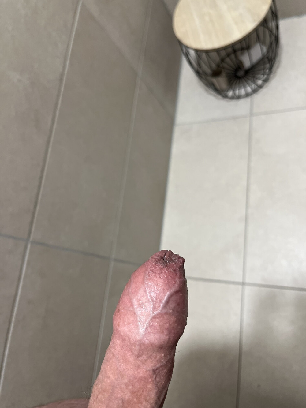 Penis