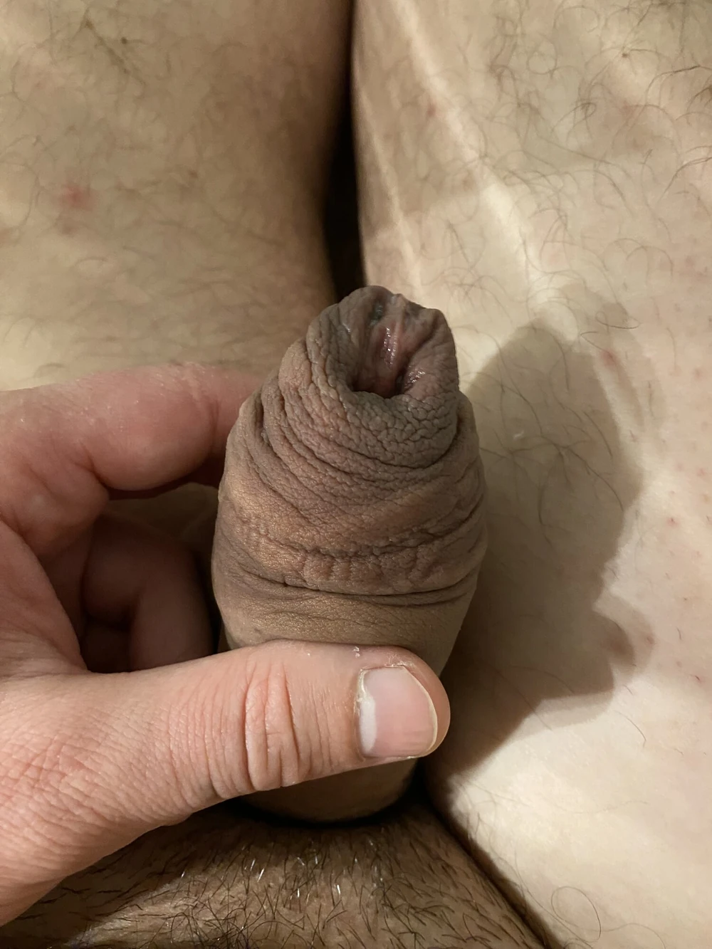 foreskin stretching #5