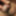 Tiny Dick, Micropenis  #4