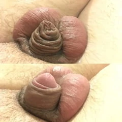 My micropenis 