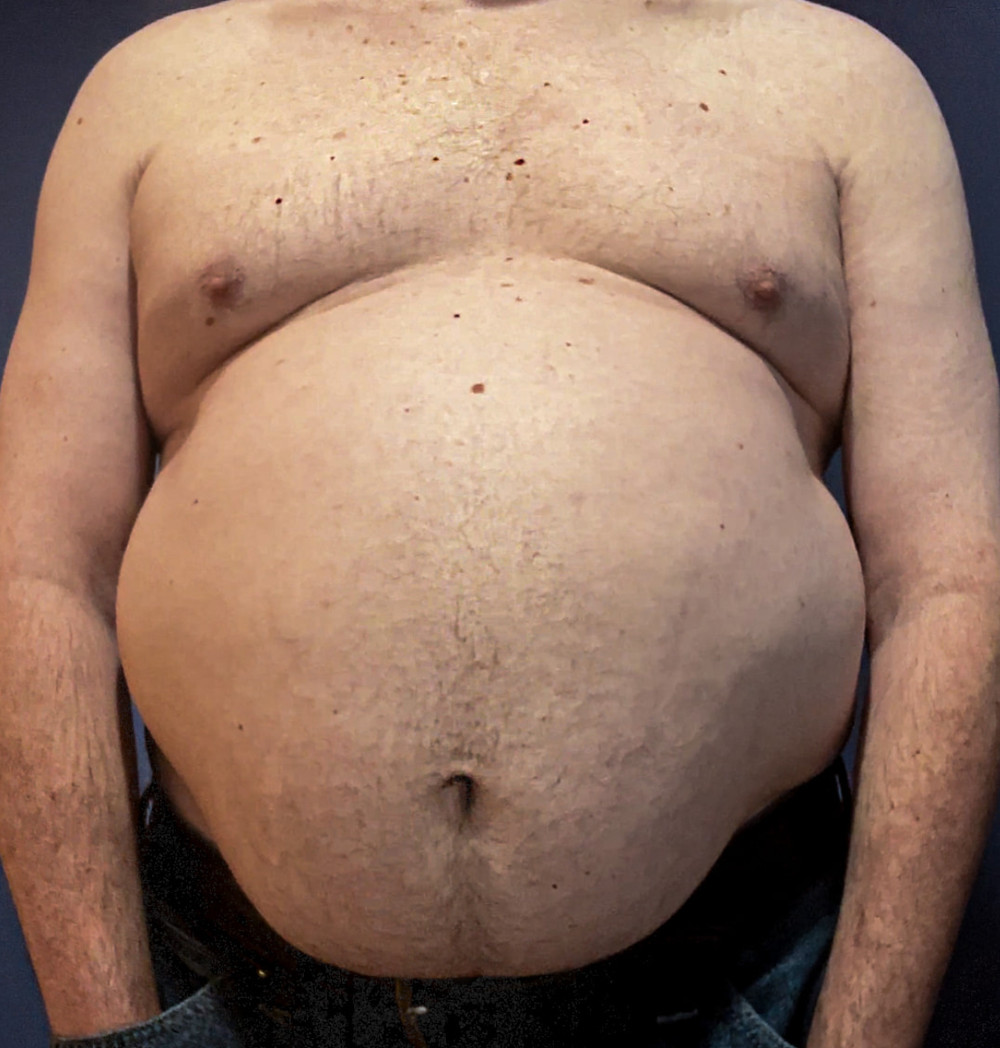 Ximd9000 Big Bloated Belly #3