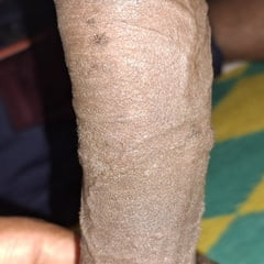 Yeni fotoğraflar 