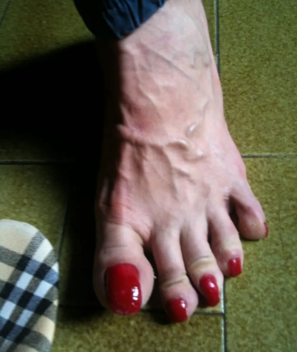 red toenails mix (older, dirty, toe ring, sandals mixed). #6