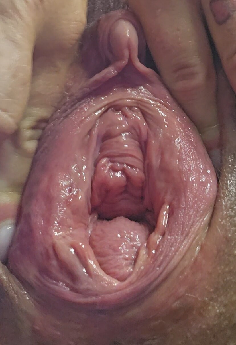 Closeup of my squirting prolapse pussy and a fucked urethral #2