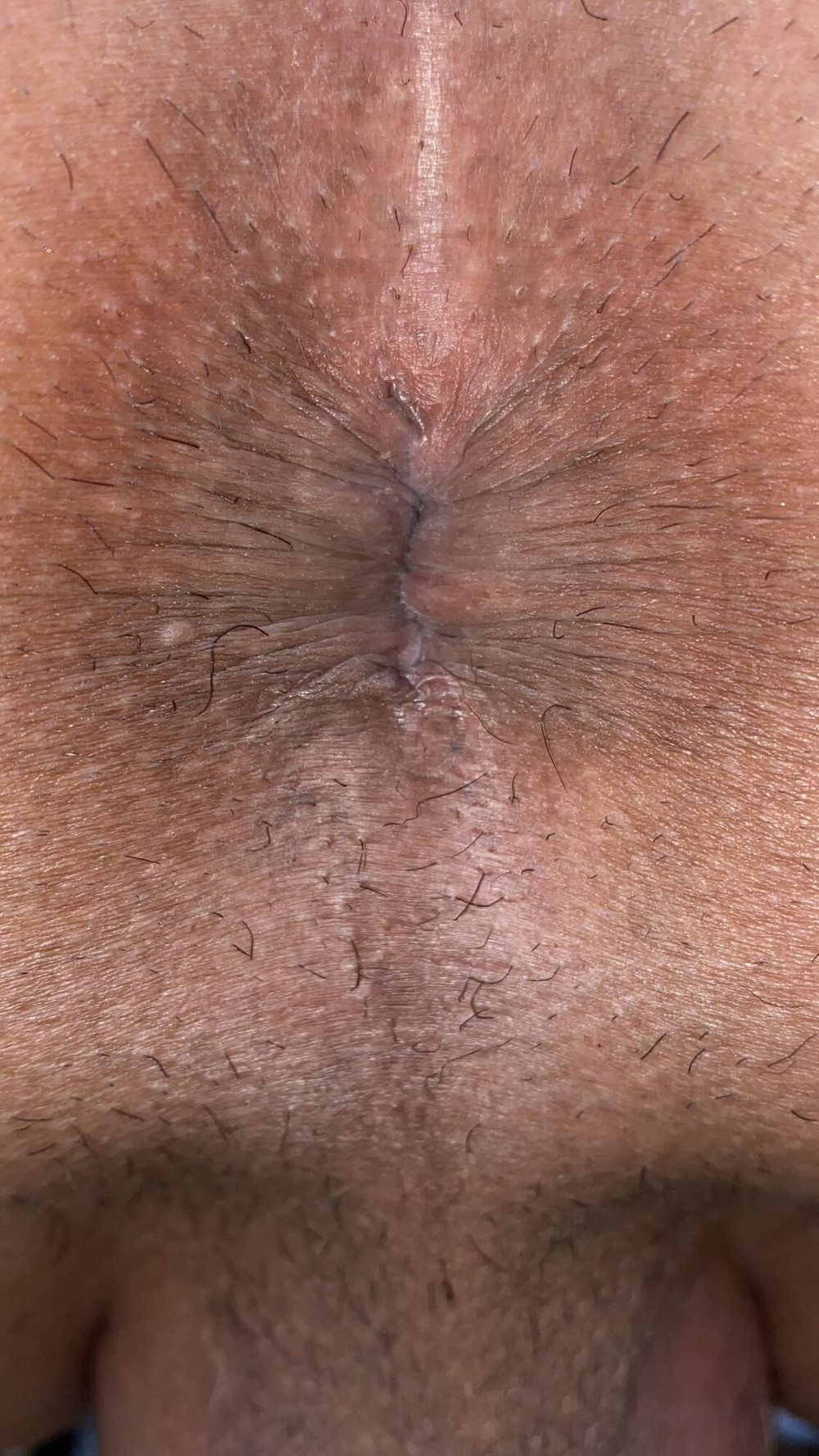 Close-up of a man&#039;s anus #46
