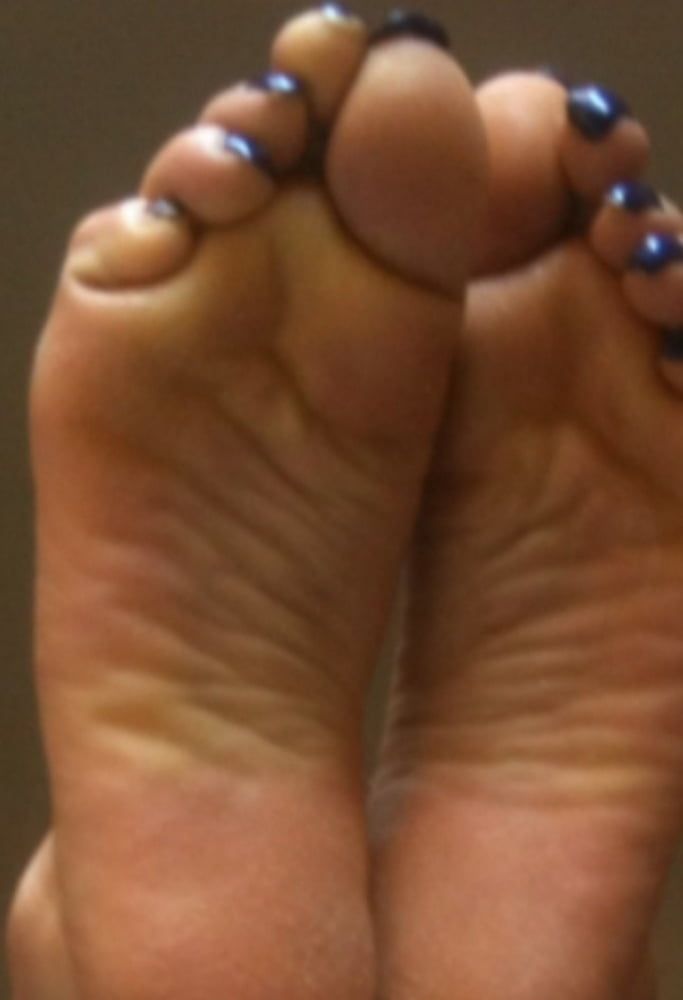 blue toenails and soles feet after day at beach  #38