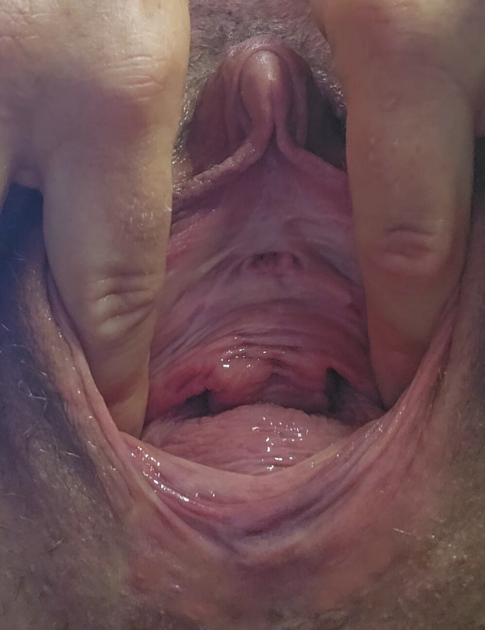 Closeup of my squirting prolapse pussy and a fucked urethral #6