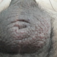 Hairy Balls