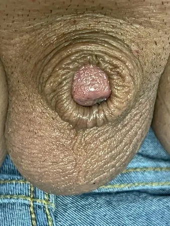 inverted tiny penis         