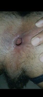 Ass hole