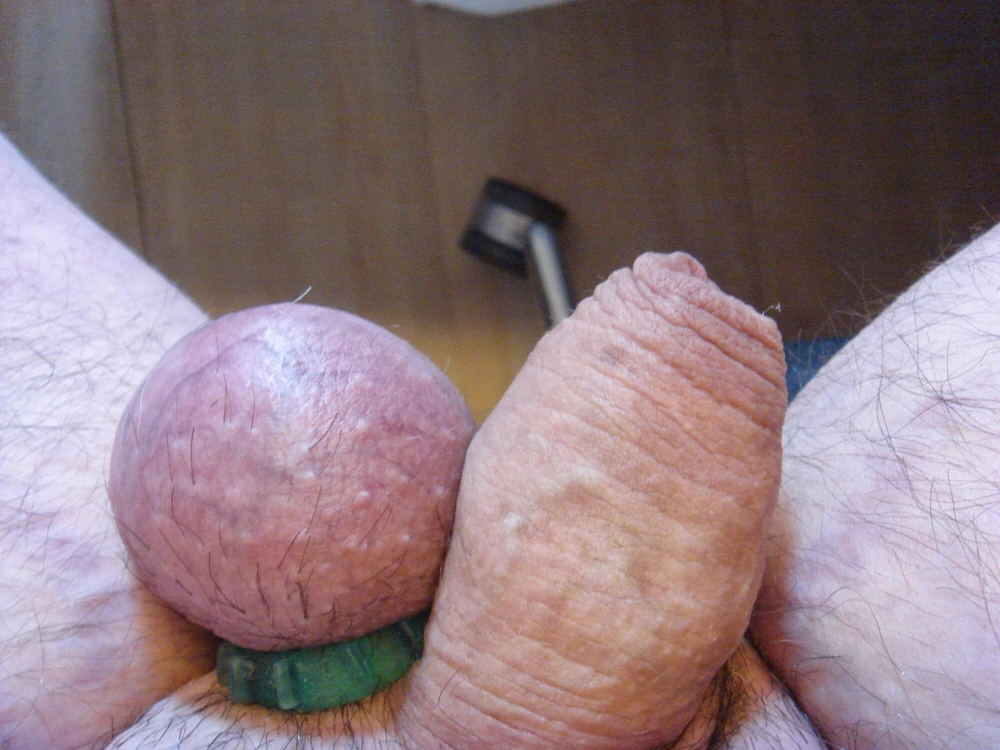 Micro penis #35