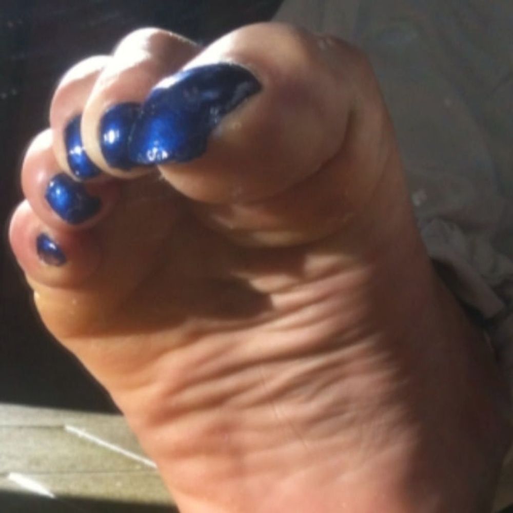 Blue toenails under sun ray #3