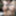 Breast pictures