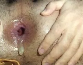 Anal Fucked