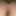 My gaped hole #2