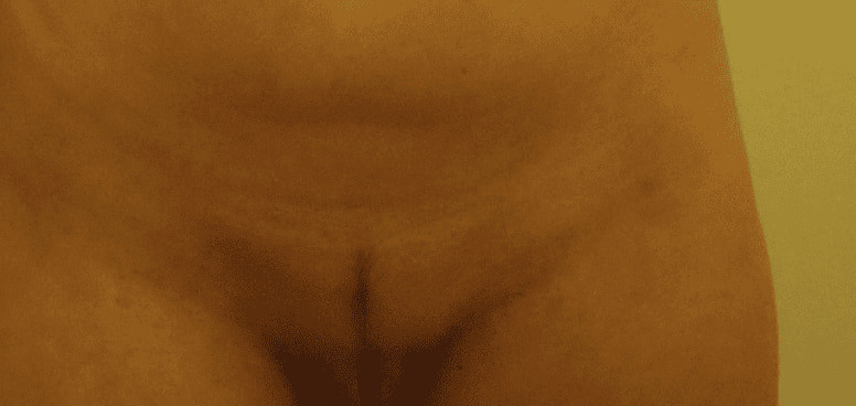 Exposed Elegance #14