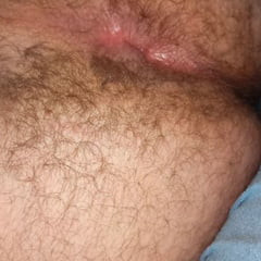 18yo hairy ass