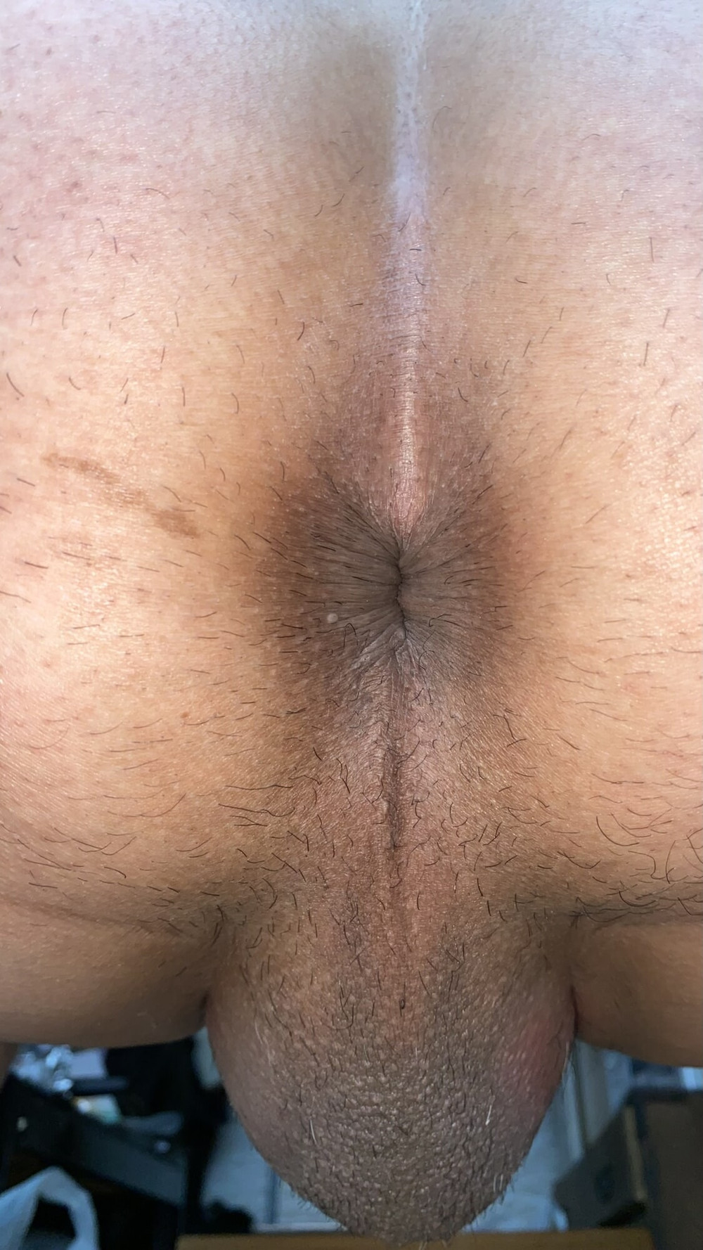 Close-up of a man&#039;s anus #3