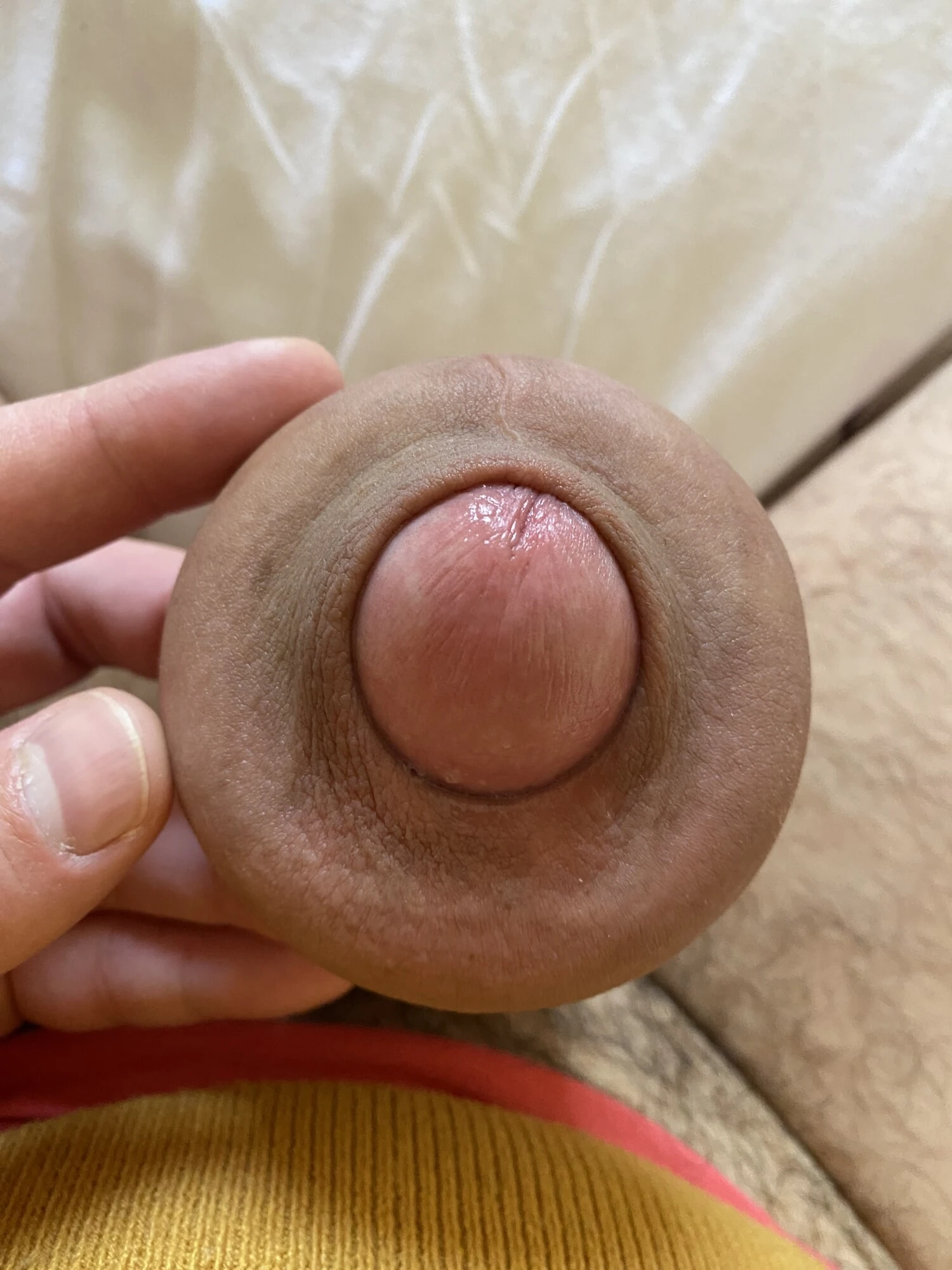 Extreme stretching foreskin