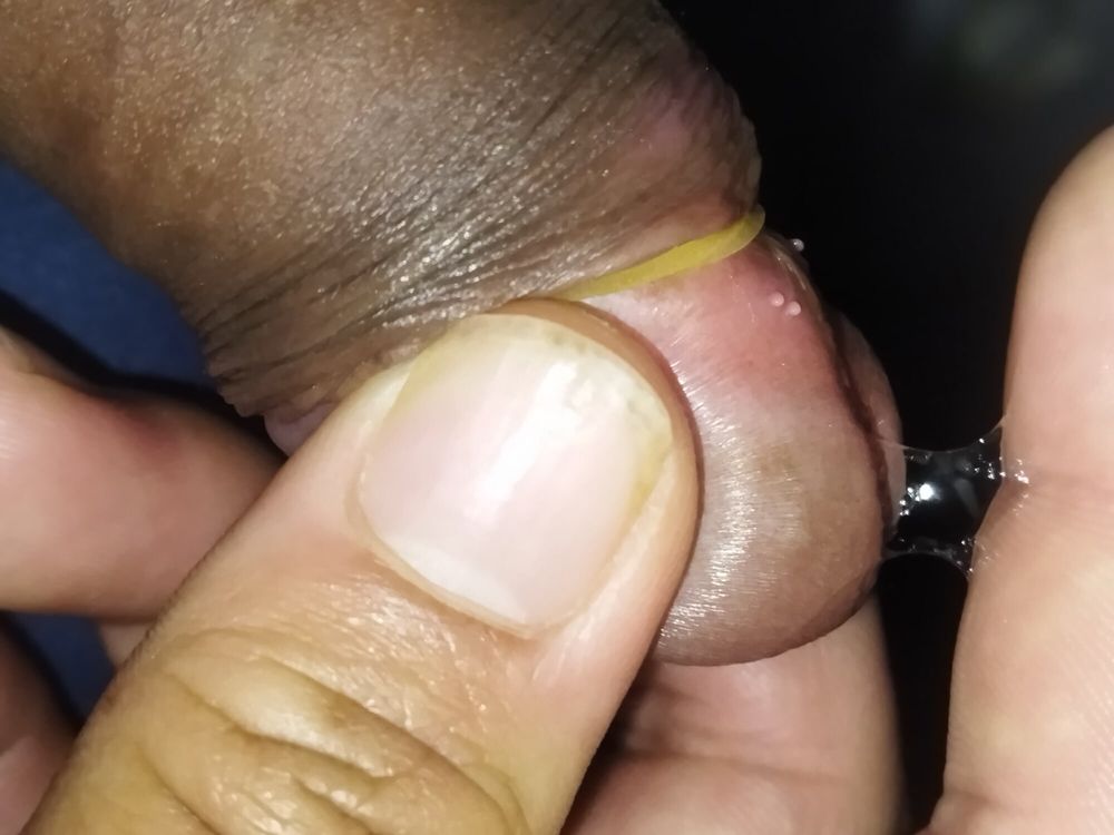 nepali semali Penile(Penis #3