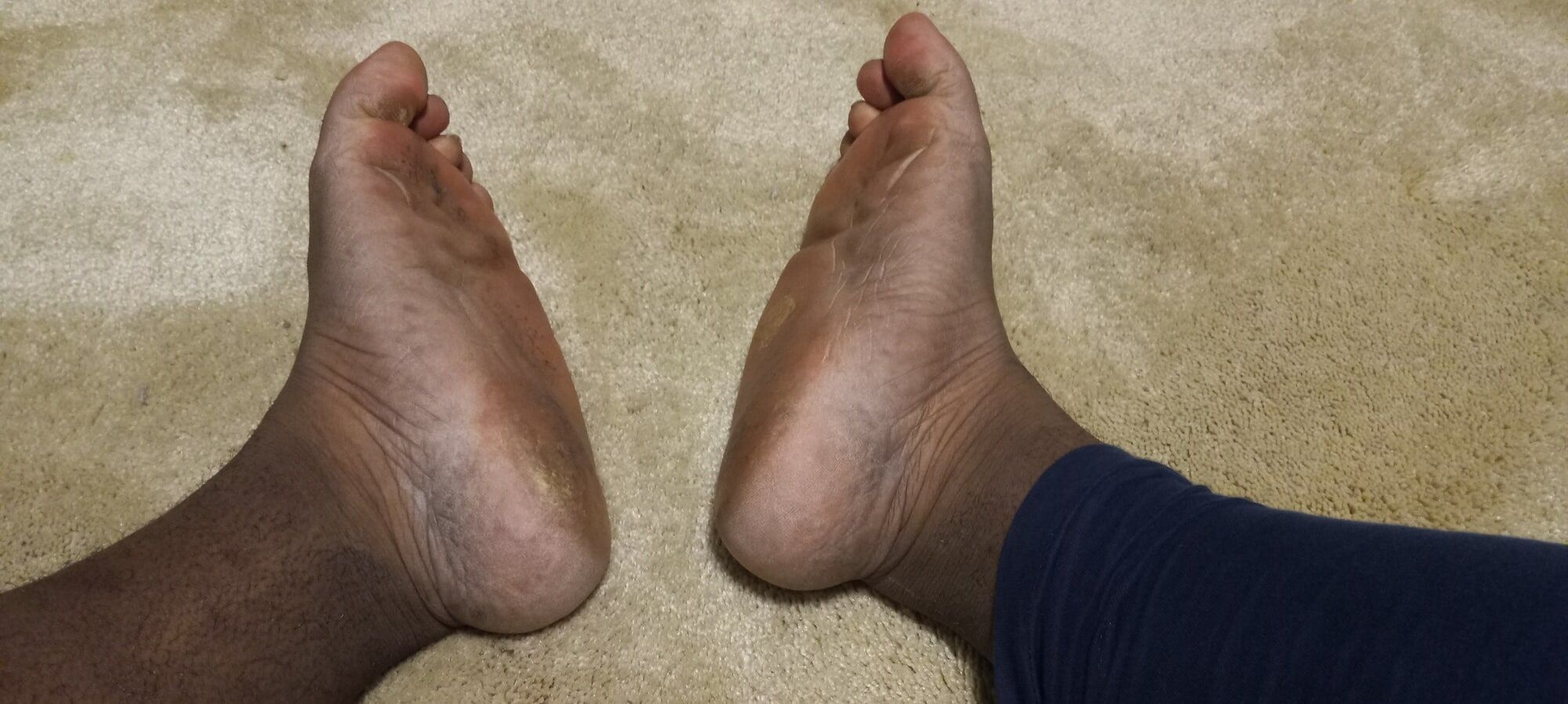 Pics of my Feet #15