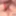 double anal vaginal