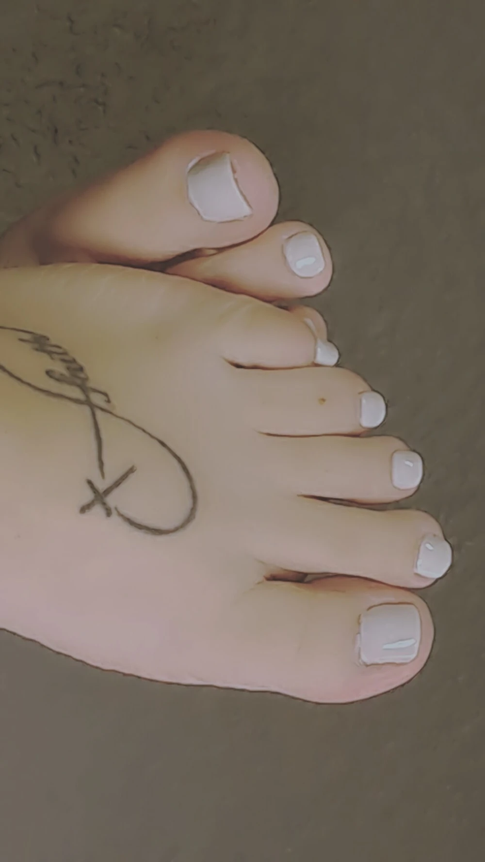Legs & Feet