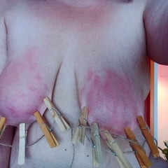 Don&#039;t they look pretty when they are bruised and abused?,