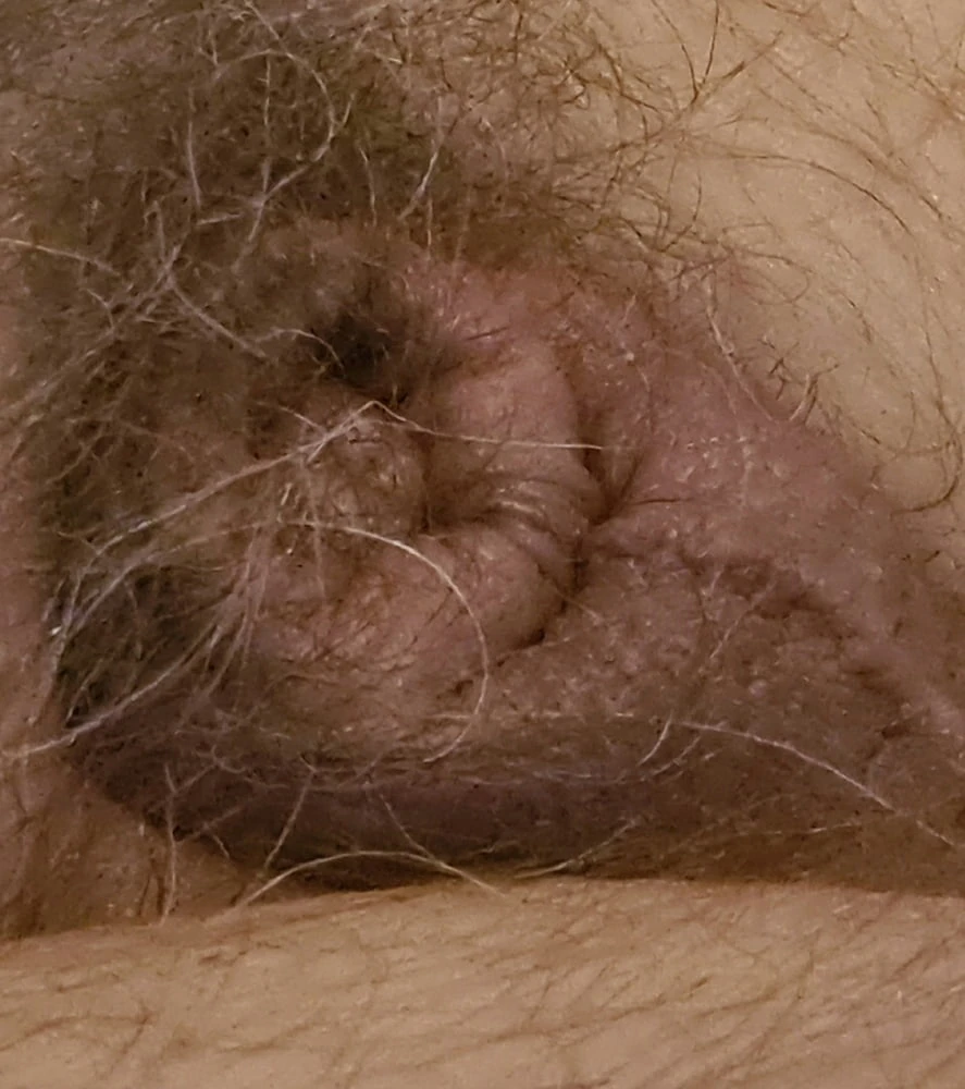 My small penis #3