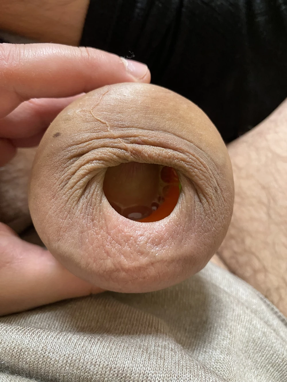 Foreskin stretching ring porn