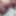 My penis before tugging 2025 #5
