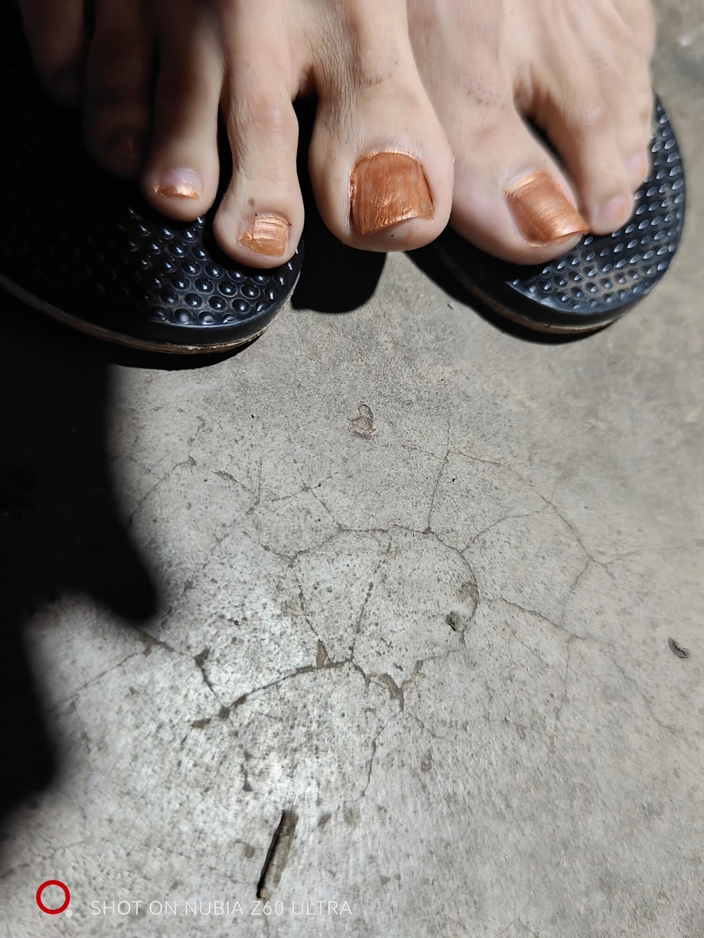 Feet CsG 1.1