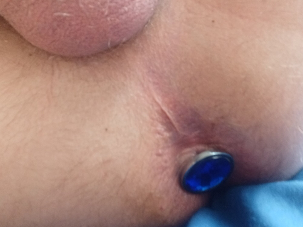 Horny #24