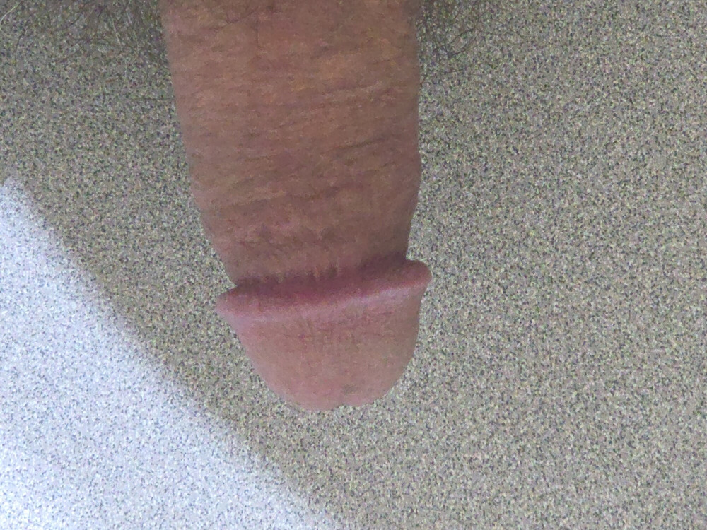 My dick #2