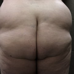 Fat add