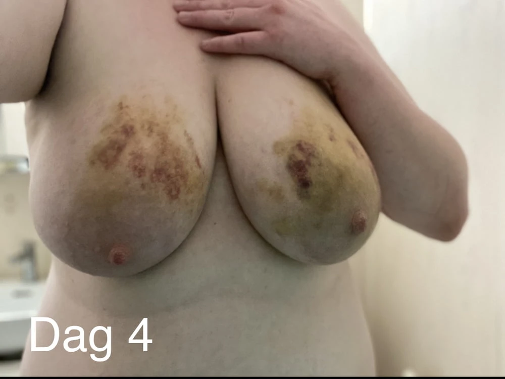 My body #8