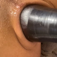 Anal Ass all 