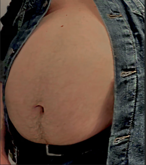 Ximd9000 Big Bloated Belly #17