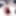 Giant gaping asshole 2 7cm gapes spread assfist butt 10.2010 #4