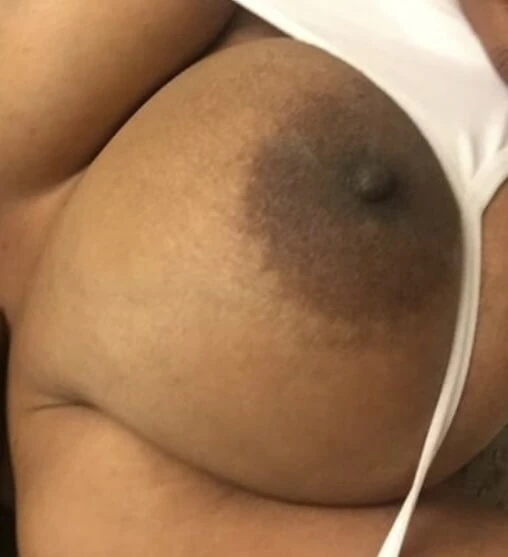Nipples
