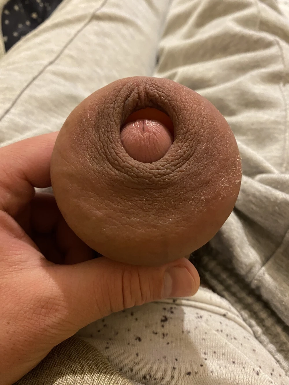 extreme stretching foreskin #5