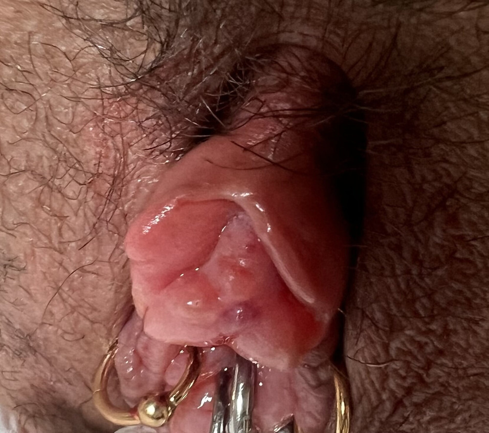 Clitoris suction #3