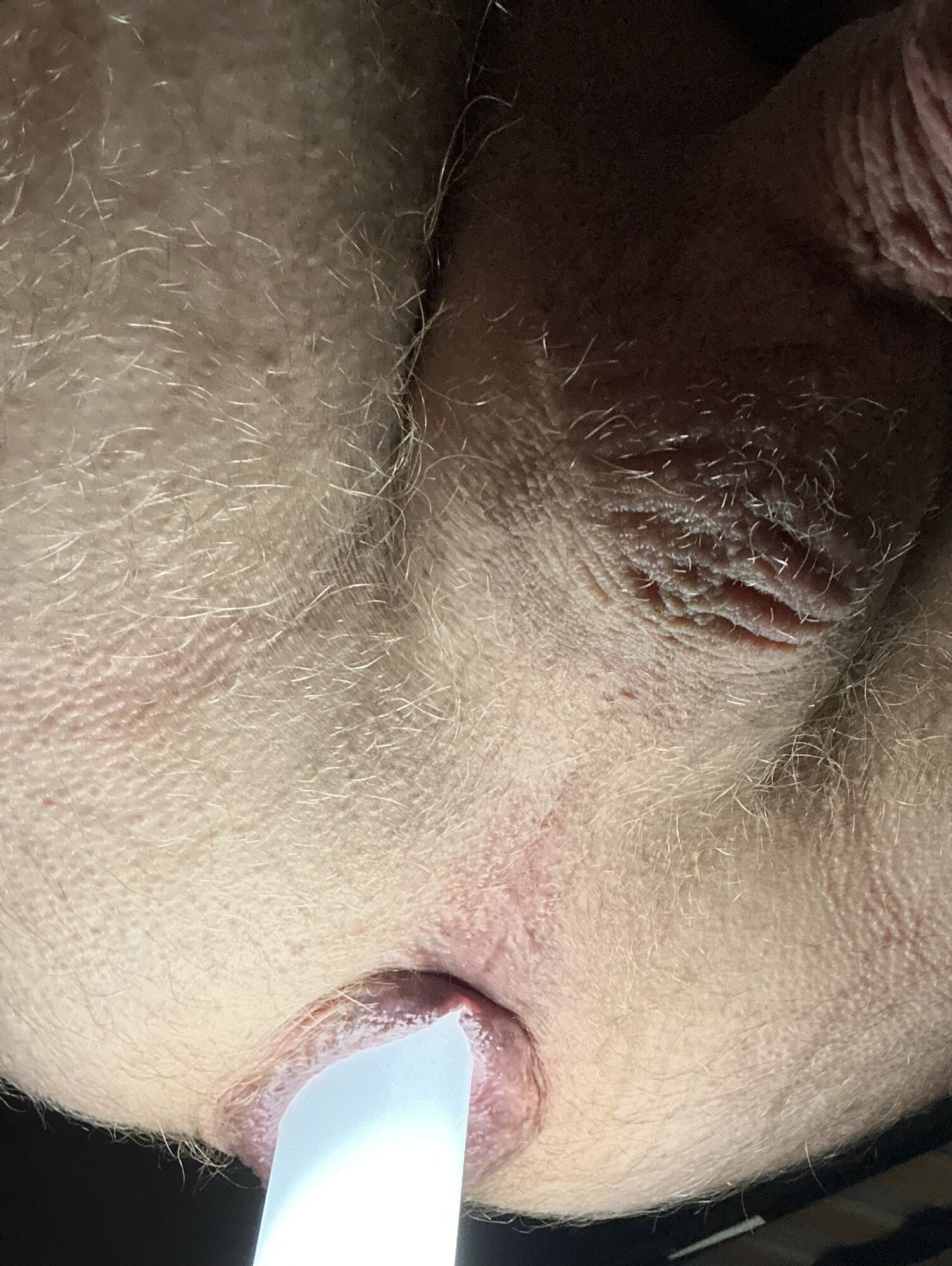 Anus