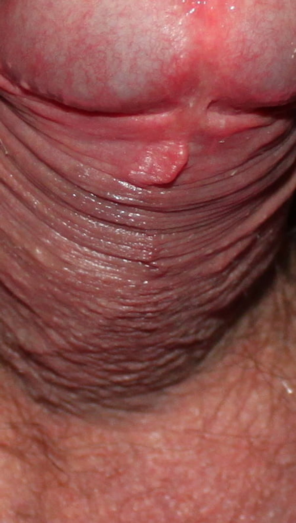 Close up dick #18