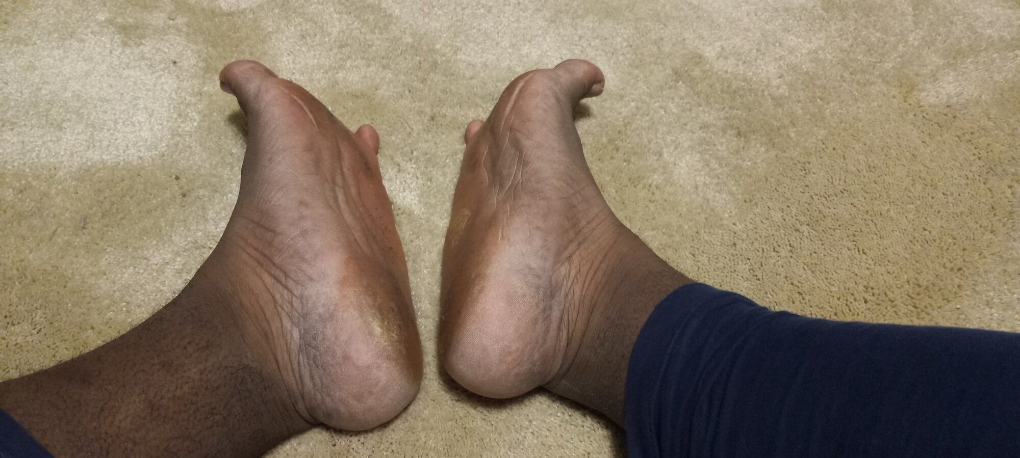 Pics of my Feet #20