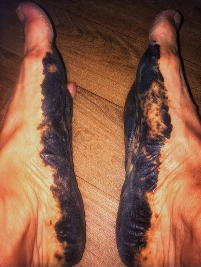 My feet with henna tattoo