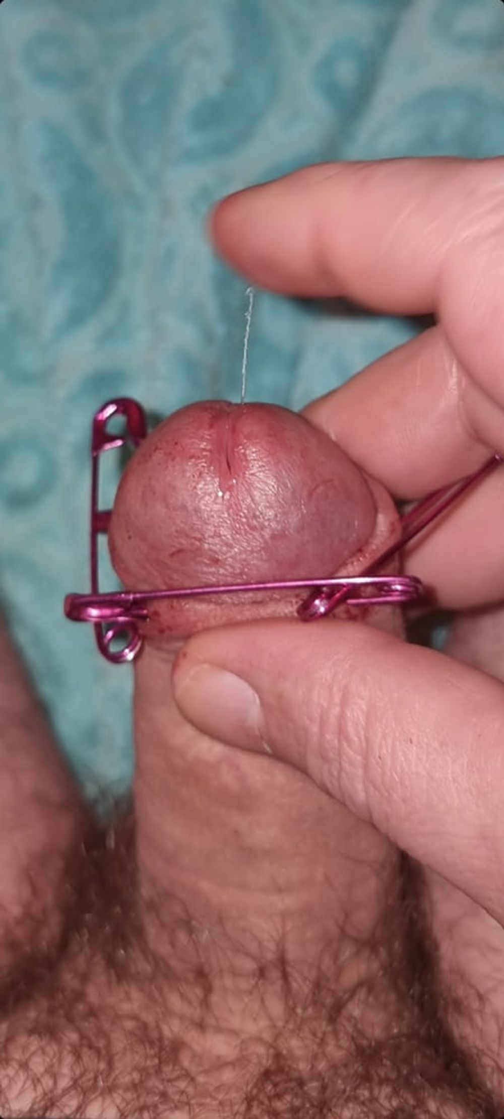 NEEDLES IN FORESKIN 😝 #2