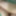 micro penis or big clit? #11