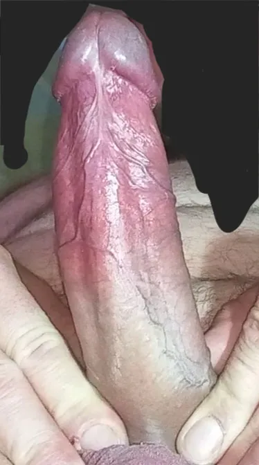 My penis #5